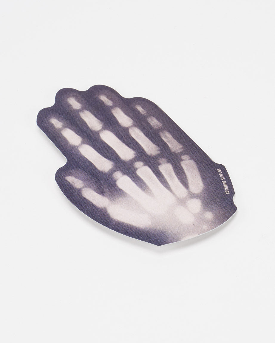 StXrayHand_01.jpg